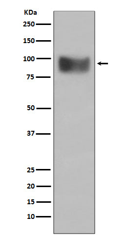 Western blot analysis of Interferon Receptor alpha expression in SH-SY5Y cell lysate.