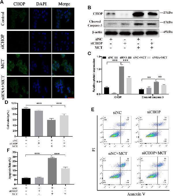 Anti-DDIT3/Chop Rabbit Monoclonal Antibody