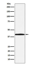Western blot analysis of BGAT expression in 293T cell lysate.