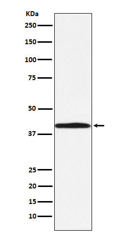 Western blot analysis of BGAT expression in 293T cell lysate.