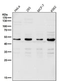 All lanes use the Antibody at 1:2K dilution for 1 hour at room temperature.