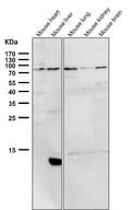 All lanes use the Antibody at 1:2K dilution for 1 hour at room temperature.