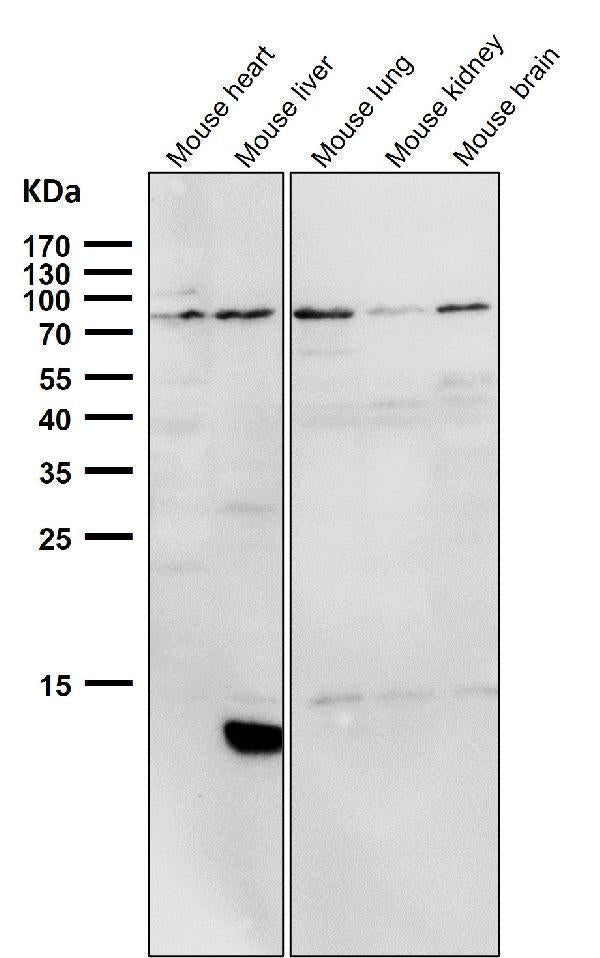 All lanes use the Antibody at 1:2K dilution for 1 hour at room temperature.