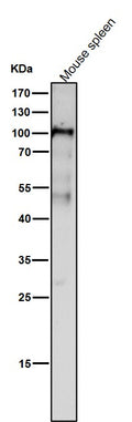 All lanes use the Antibody at 1:1W dilution for 1 hour at room temperature.