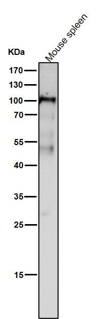 All lanes use the Antibody at 1:1W dilution for 1 hour at room temperature.