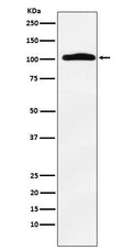 Western blot analysis of Thyroid Peroxidase expression in Human thyroid lysate.