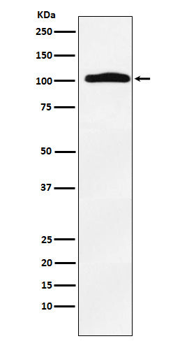 Western blot analysis of Thyroid Peroxidase expression in Human thyroid lysate.