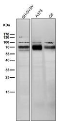 All lanes use the Antibody at 1:5K dilution for 1 hour at room temperature.