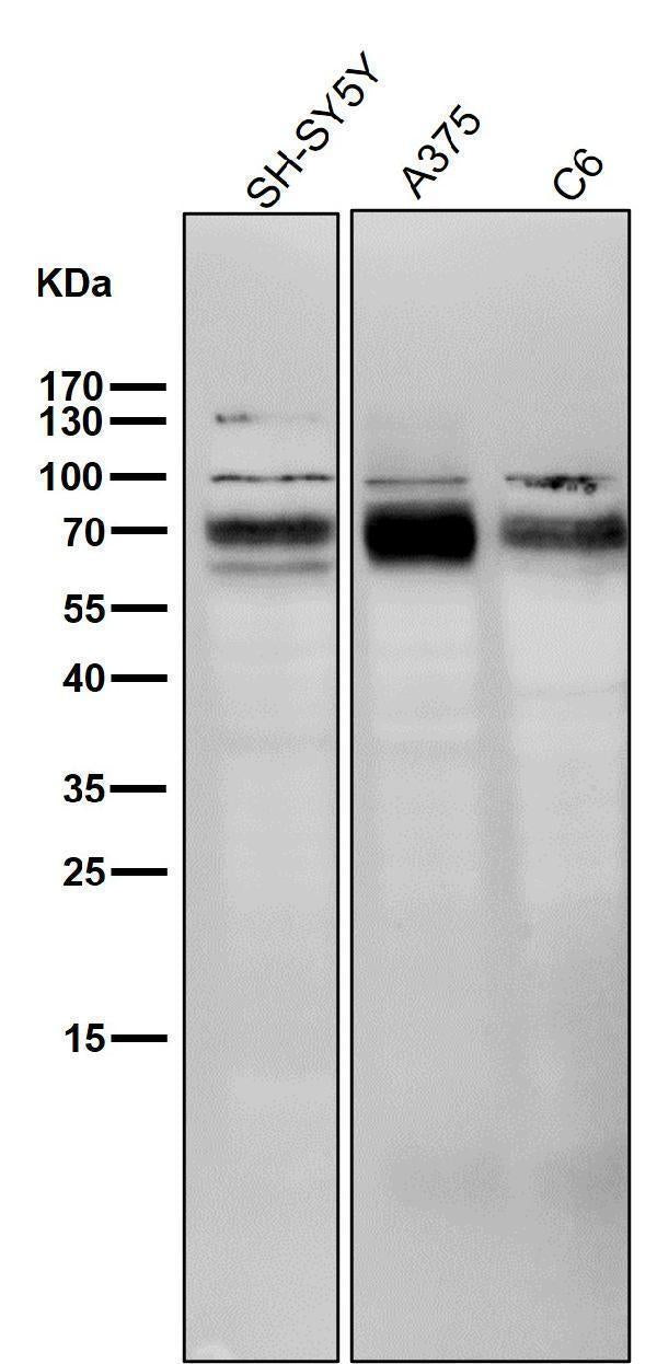 All lanes use the Antibody at 1:5K dilution for 1 hour at room temperature.