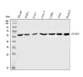Anti-HDAC2/Histone Deacetylase 2 Rabbit Monoclonal Antibody