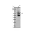 Anti-Tyrosinase Rabbit Monoclonal Antibody