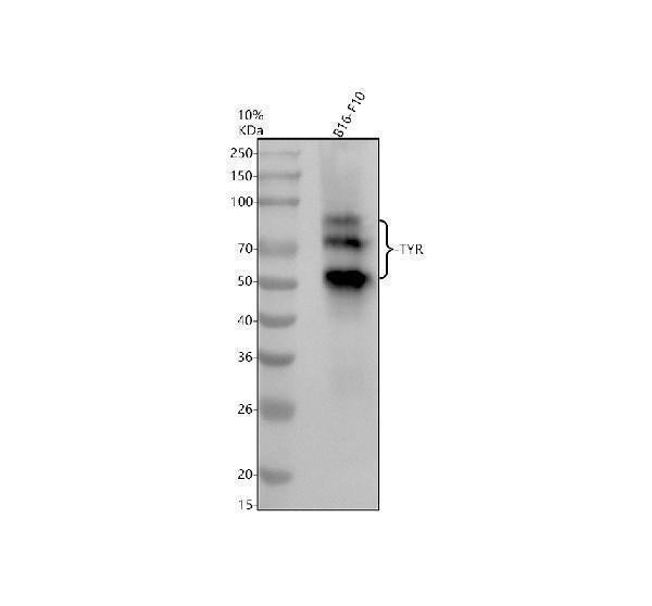 Anti-Tyrosinase Rabbit Monoclonal Antibody