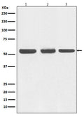 Western blot analysis of Beclin 1 expression in (1) HEK293 cell lysate; (2) NIH/3T3 cell lysate; (3) C6 cell lysate.
