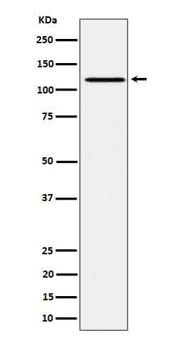 Western blot analysis of Phospho-JAK1 (Y1034 + Y1035) expression in Ramos treated with pervanadate cell lysate.