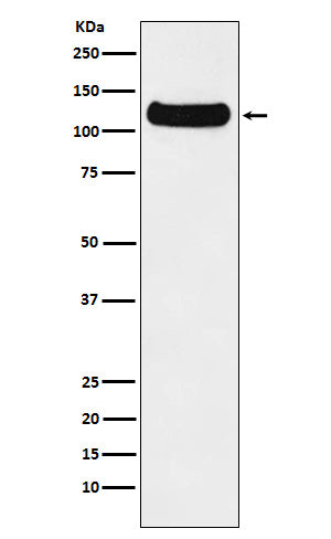 Western blot analysis of DDB1 expression in HeLa cell lysate.