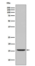 Western blot analysis of active Caspase-3 expression in Jurkat cell lysate treated with Camptothecin.