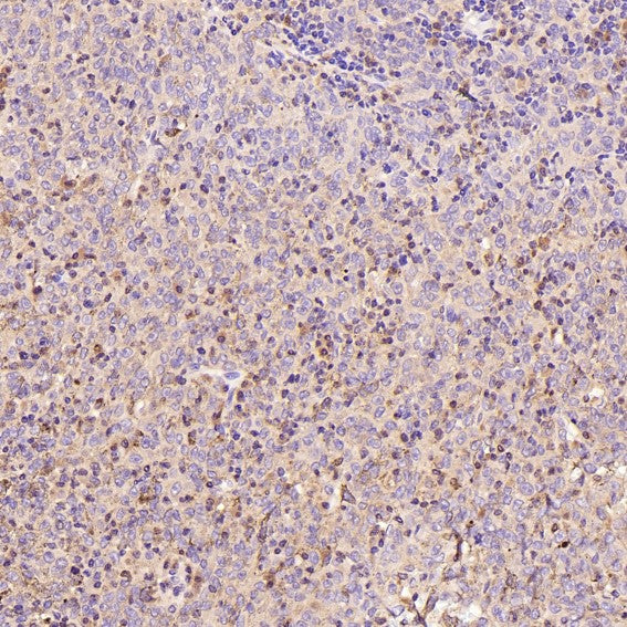 Anti-active + pro Caspase 3 CASP3 Rabbit Monoclonal Antibody