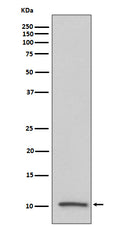 Western blot analysis of IGF2 expression in human serum lysate.