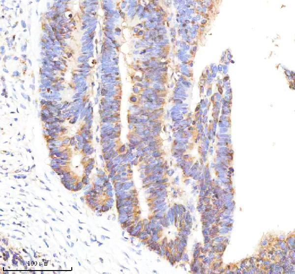 Anti-Tissue Factor Rabbit Monoclonal Antibody
