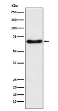 Western blot analysis of CYP24A1 expression in Human fetal liver lysate.