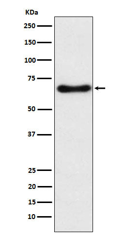 Western blot analysis of CYP24A1 expression in Human fetal liver lysate.