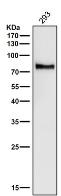 All lanes use the Antibody at 1:1W dilution for 1 hour at room temperature.