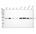 Anti-SOD2 (acetyl K68) Rabbit Monoclonal Antibody
