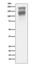 Western blot analysis of CEA(CD66e) expression in Human colon cancer lysate.