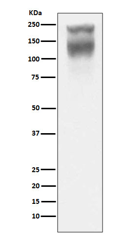 Western blot analysis of CEA(CD66e) expression in Human colon cancer lysate.