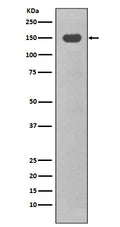 Anti-CD11c ITGAX Rabbit Monoclonal Antibody