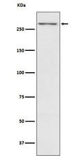 Western blot analysis of Thyroglobulin expression in Human thyroid lysate.