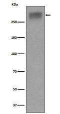 Western blot analysis of Thyroglobulin expression in Human thyroid lysate.