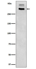 Western blot analysis of Thyroglobulin expression in Human thyroid lysate lysate.