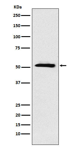 Western blot analysis of ETV6 expression in A431 cell lysate.