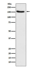Western blot analysis of Hamartin expression in HeLa cell lysate.
