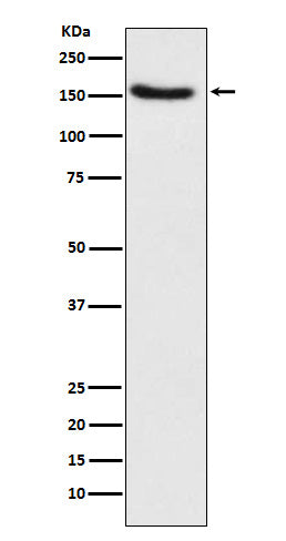 Western blot analysis of Hamartin expression in HeLa cell lysate.