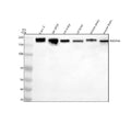 Anti-PDGFR alpha Rabbit Monoclonal Antibody