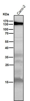 All lanes use the Antibody at 1:1K dilution for 1 hour at room temperature.