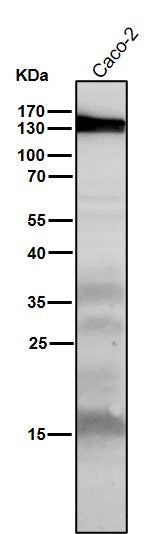 All lanes use the Antibody at 1:1K dilution for 1 hour at room temperature.