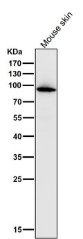 All lanes use the Antibody at 1:1K dilution for 1 hour at room temperature.