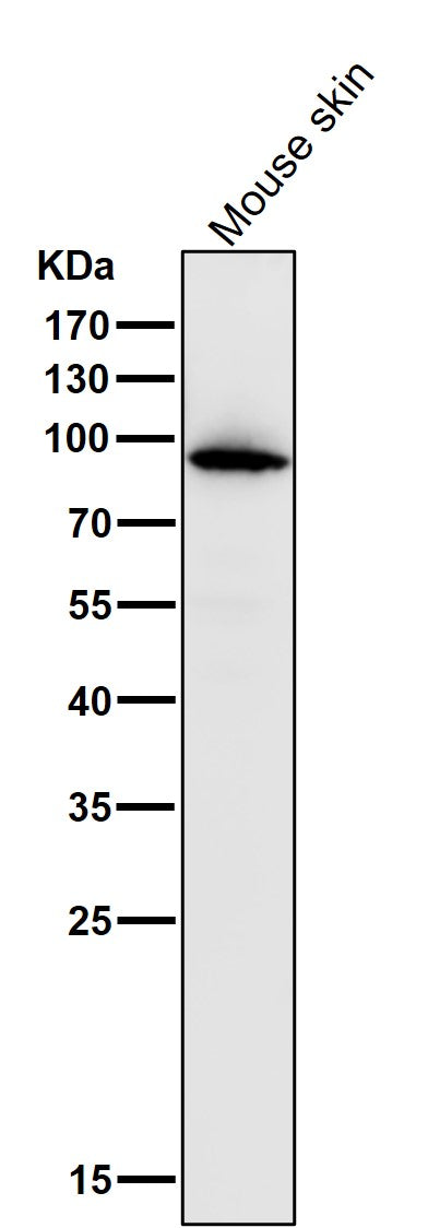 All lanes use the Antibody at 1:1K dilution for 1 hour at room temperature.