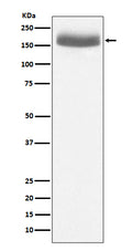 Western blot analysis of EGF expression in human urine sample lysate.