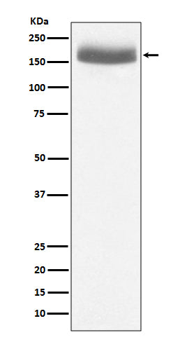 Western blot analysis of EGF expression in human urine sample lysate.