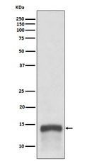 Western blot analysis of S100A9 expression in human tonsil lysate.