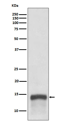 Western blot analysis of S100A9 expression in human tonsil lysate.