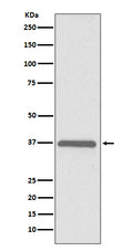 Western blot analysis of ERCC1 expression in HeLa cell lysate.