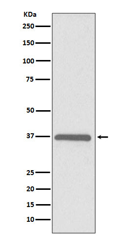 Western blot analysis of ERCC1 expression in HeLa cell lysate.