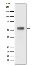 Western blot analysis of Retinoic Acid Receptor alpha expression in MCF-7 cell lysate.