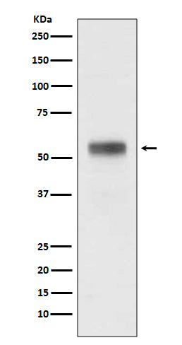 Western blot analysis of Retinoic Acid Receptor alpha expression in MCF-7 cell lysate.