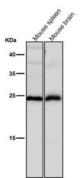 Anti-Interferon gamma IFNG Rabbit Monoclonal Antibody